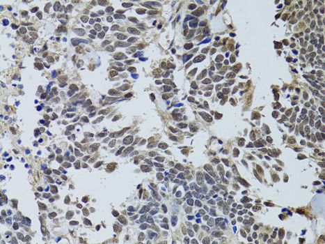 Immunohistochemistry - STK11 antibody (144-02122)