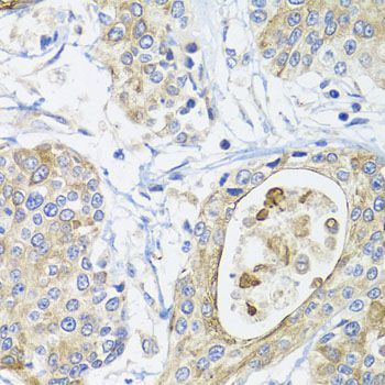 Immunohistochemistry - GSTA2 antibody (144-07678)