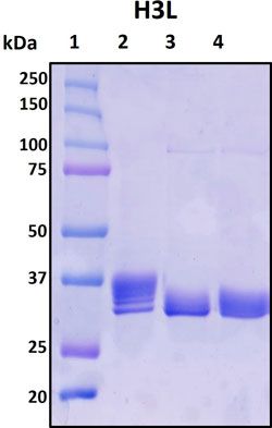 SDS-PAGE