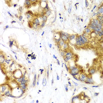 Immunohistochemistry - TOMM20 antibody (144-06774)