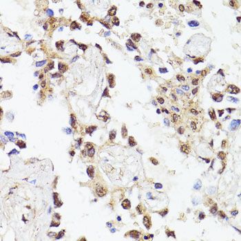 Immunohistochemistry - TWIST1 antibody (144-61361)
