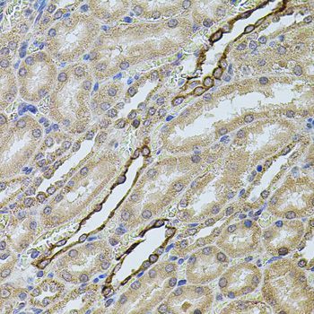Immunohistochemistry - CHRFAM7A antibody (144-07844)