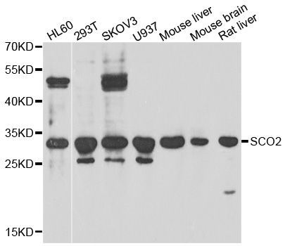 Western blot - SCO2 Polyclonal Antibody (144-07051)