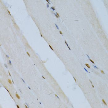 Immunohistochemistry - MAPK3 Polyclonal Antibody (144-00228)