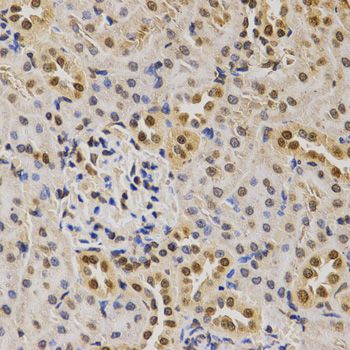 Immunohistochemistry - DiMethyl-Histone H3-K79 antibody (144-61341)