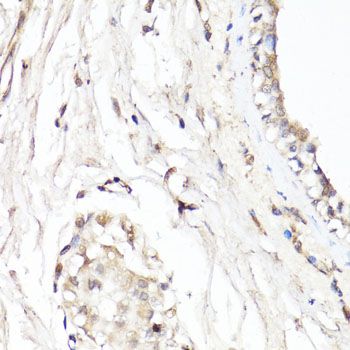 Immunohistochemistry - CDK7 antibody (144-012942)