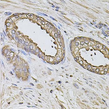 Immunohistochemistry - S100A12 antibody (144-05328)