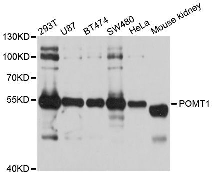 Western blot - POMT1 Polyclonal Antibody (144-10281)