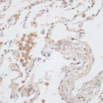 Immunohistochemistry - EGFR antibody (144-02069)