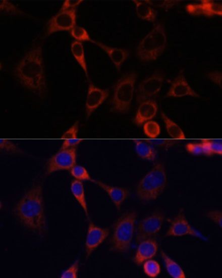 Immunofluorescence - IGF2R Polyclonal Antibody (144-60151)