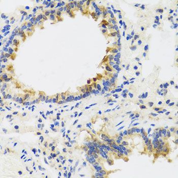 Immunohistochemistry - UVRAG antibody (144-08462)