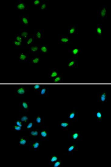 Immunofluorescence - RUNX1 antibody (144-02055)