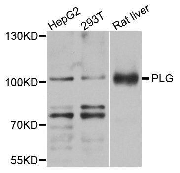 Western blot - PLG Polyclonal Antibody (144-03320)