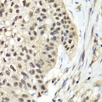 Immunohistochemistry - RFC5 Polyclonal Antibody (144-08056)