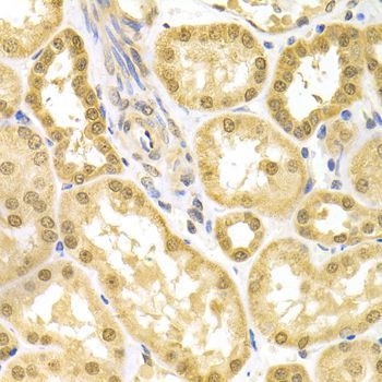 Immunohistochemistry - BAG1 Antibody (144-01104)
