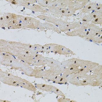 Immunohistochemistry - POP4 antibody (144-04452)