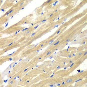 Immunohistochemistry - AIMP1 antibody (144-05301)