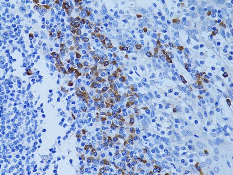 Immunohistochemistry - ATG7 Polyclonal Antibody (144-00691)