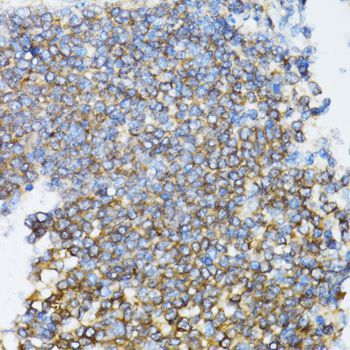 Immunohistochemistry - UBE2D1 antibody (144-01951)