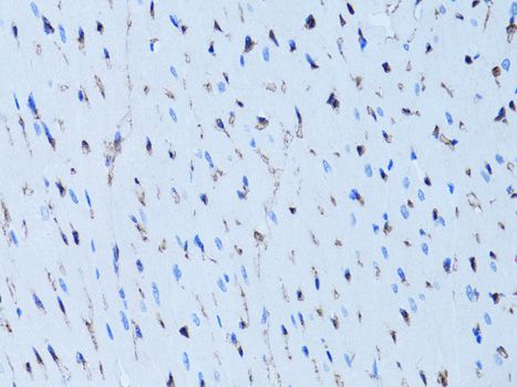 Immunohistochemistry - FABP4 Polyclonal Antibody (144-00232)