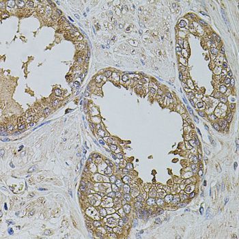 Immunohistochemistry - KTN1 antibody (144-05879)