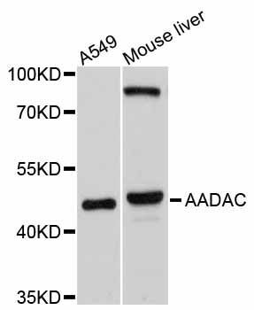 Western blot - AADAC Polyclonal Antibody (144-10365)