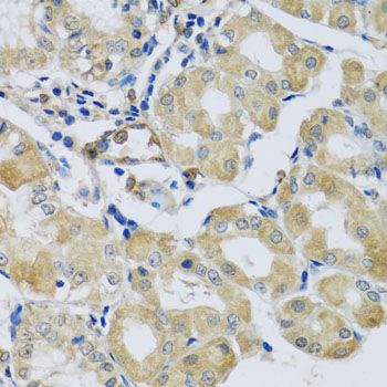 Immunohistochemistry - SYT11 antibody (144-08198)