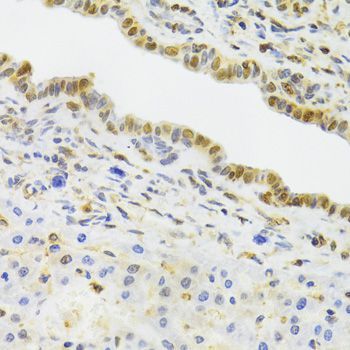 Immunohistochemistry - EFTUD2 Antibody (144-07040)