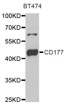 Western blot - CD177 antibody (144-06550)