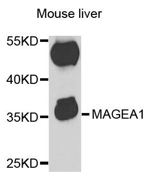 Western blot - MAGEA1 antibody (144-05470)