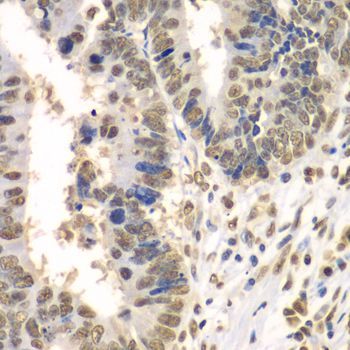 Immunohistochemistry - HDAC2 Polyclonal Antibody (144-02084)