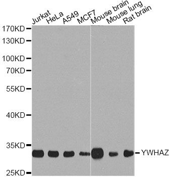 Western blot - YWHAZ Antibody (144-013370)