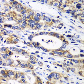 Immunohistochemistry - RPN1 antibody (144-600827)