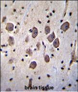 IHC-P