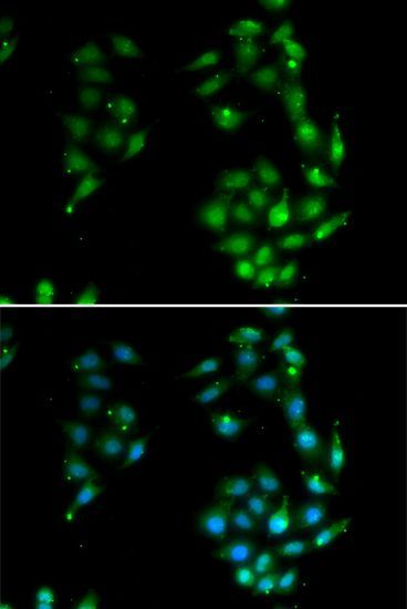 Immunofluorescence - SOX5 Polyclonal Antibody (144-06985)