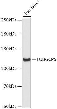 Western blot