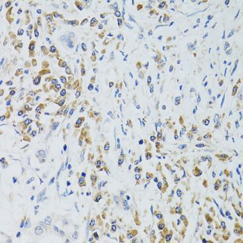 Immunohistochemistry - SRP19 Polyclonal Antibody (144-06752)