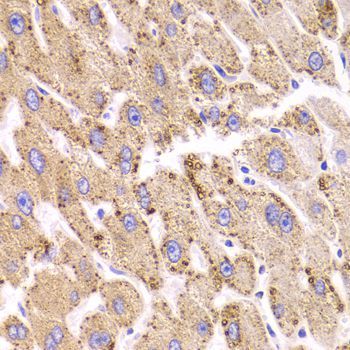 Immunohistochemistry - HSD17B13 Antibody (144-06256)