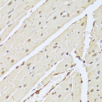 Immunohistochemistry - RUNX1 Antibody (144-02055)