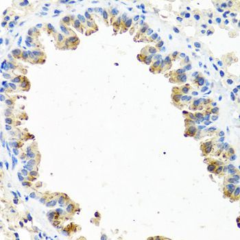 Immunohistochemistry - GNRH2 antibody (144-08424)