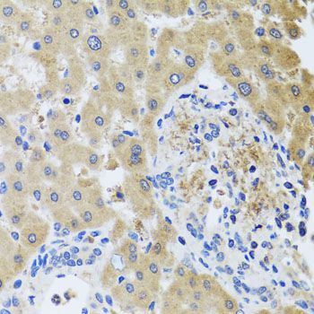 Immunohistochemistry - RHOB antibody (144-02819)