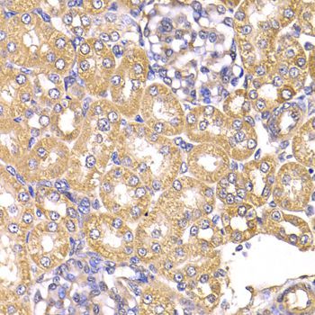 Immunohistochemistry - LAP3 antibody (144-07101)