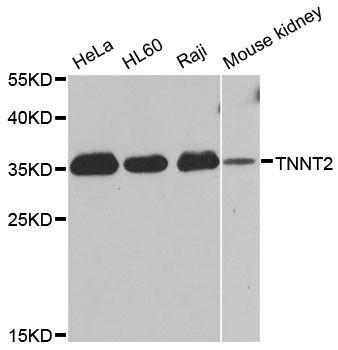 Western blot - TNNT2 antibody (144-01126)