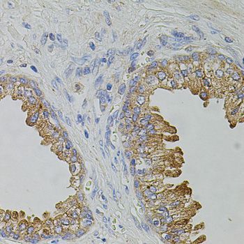 Immunohistochemistry - TRPA1 Polyclonal Antibody (144-08568)