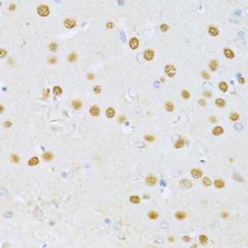 Immunohistochemistry - SATB1 antibody (144-05800)
