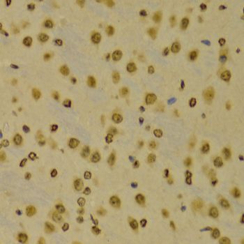 Immunohistochemistry - TriMethyl-Histone H3-K9 antibody (144-02360)