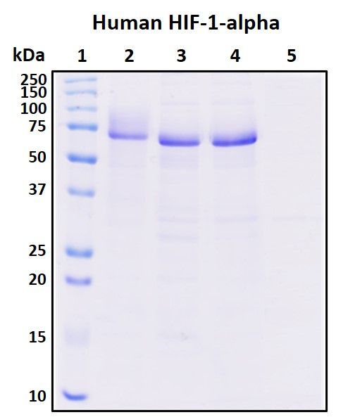 SDS-PAGE