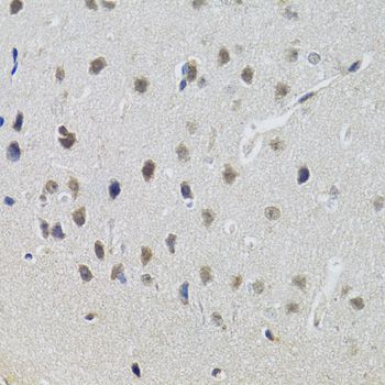 Immunohistochemistry - STAT1 Polyclonal Antibody (144-00027)