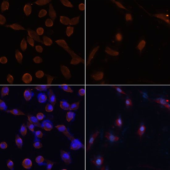 Immunofluorescence - MAP1LC3B Polyclonal Antibody (144-07198)