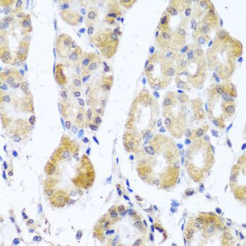 Immunohistochemistry - MRPL11 Polyclonal Antibody (144-04945)